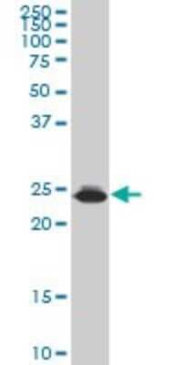 Western Blot: HMGB2 Antibody (X1) [H00003148-M07]