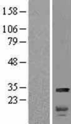 Western Blot: HMGB2 Overexpression Lysate [NBP2-09517]