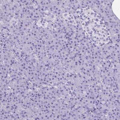 Immunohistochemistry-Paraffin: HMGB3/HMG4 Antibody [NBP2-47434]