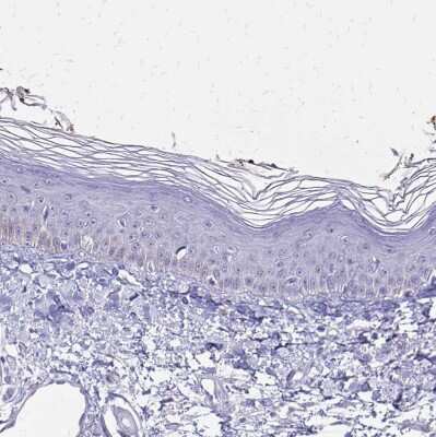 Immunohistochemistry-Paraffin: HMGB3/HMG4 Antibody [NBP2-47434]