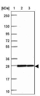 Western Blot: HMGB3/HMG4 Antibody [NBP2-47434]