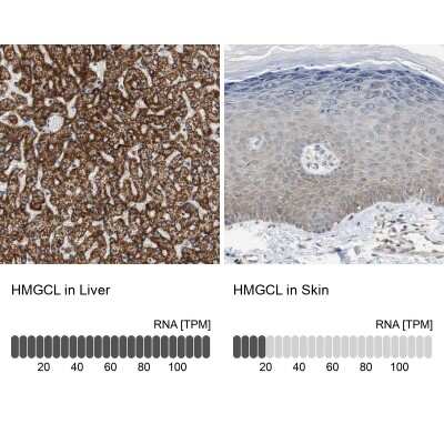 Immunohistochemistry-Paraffin: HMGCL Antibody [NBP1-83251]