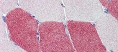 Immunohistochemistry-Paraffin: HMGCS1 Antibody [NBP1-54623]
