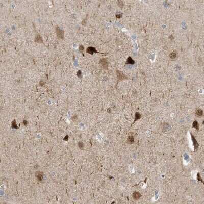 Immunohistochemistry-Paraffin: HMGCS1 Antibody [NBP1-83246]