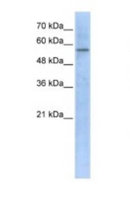 Western Blot: HMGCS1 Antibody [NBP1-54623]