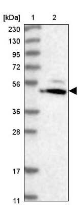 Western Blot: HMGCS1 Antibody [NBP2-14094]
