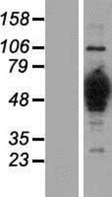 Western Blot: HMGCS1 Overexpression Lysate [NBP2-08308]