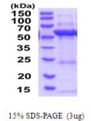 SDS-PAGE: Recombinant Human HMGCS1 His Protein [NBP2-52082]