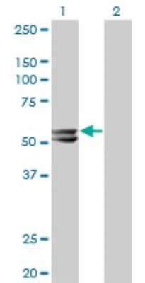 Western Blot: HMGCS2 Antibody (1E9) [H00003158-M06]