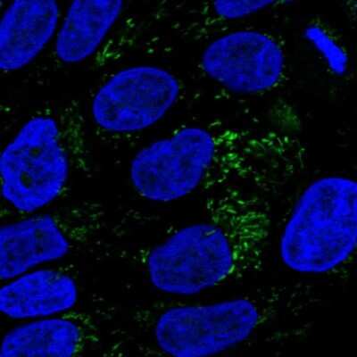 Immunocytochemistry/ Immunofluorescence: HMGCS2 Antibody [NBP2-33908]