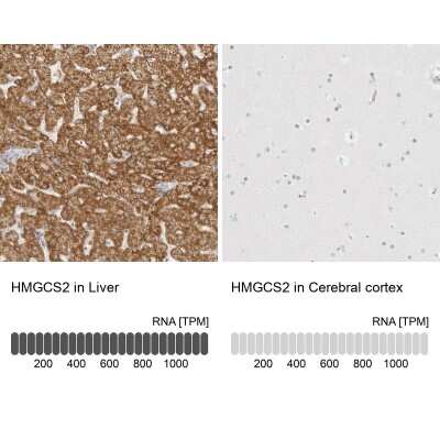 Immunohistochemistry-Paraffin: HMGCS2 Antibody [NBP2-33907]