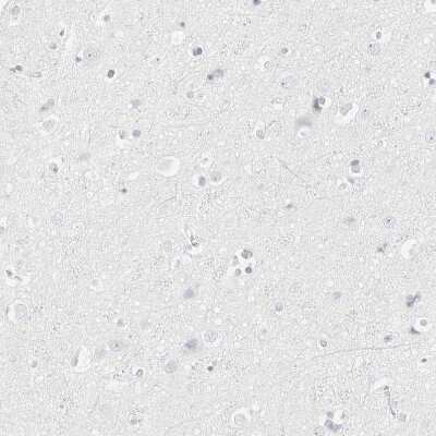 Immunohistochemistry-Paraffin: HMGCS2 Antibody [NBP2-33907]