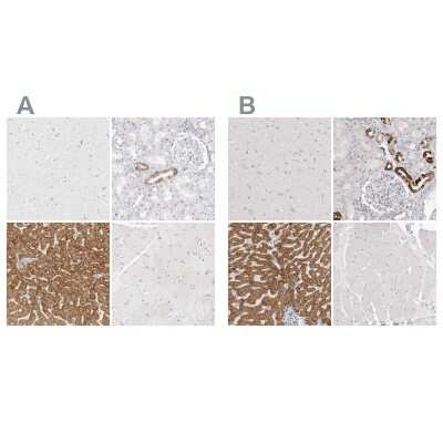 Immunohistochemistry-Paraffin: HMGCS2 Antibody [NBP2-33907]