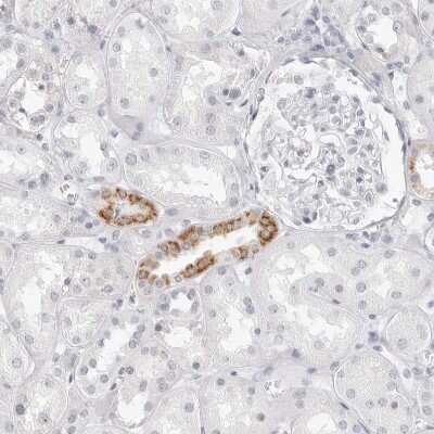 Immunohistochemistry-Paraffin: HMGCS2 Antibody [NBP2-33907]