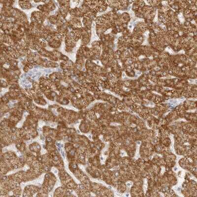 Immunohistochemistry-Paraffin: HMGCS2 Antibody [NBP2-33907]