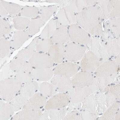 Immunohistochemistry-Paraffin: HMGCS2 Antibody [NBP2-33907]