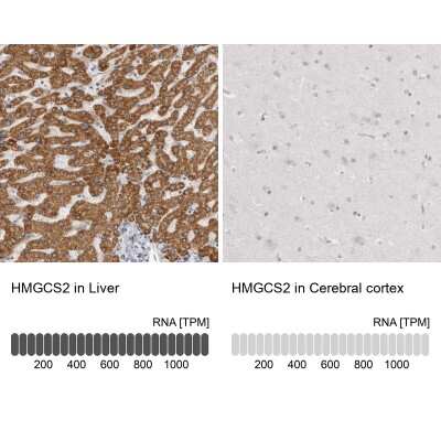 Immunohistochemistry-Paraffin: HMGCS2 Antibody [NBP2-33908]