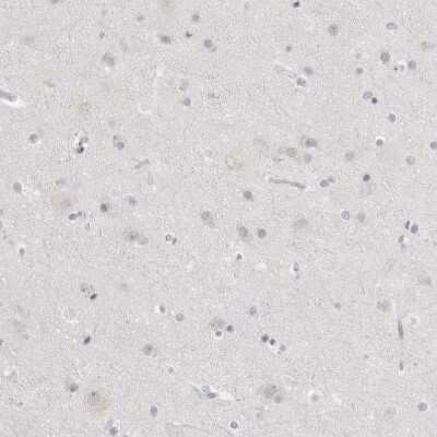 Immunohistochemistry-Paraffin: HMGCS2 Antibody [NBP2-33908]