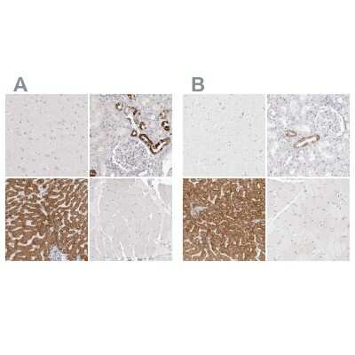 Immunohistochemistry-Paraffin: HMGCS2 Antibody [NBP2-33908]