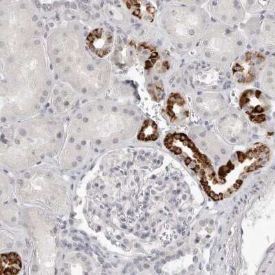 Immunohistochemistry-Paraffin: HMGCS2 Antibody [NBP2-33908]