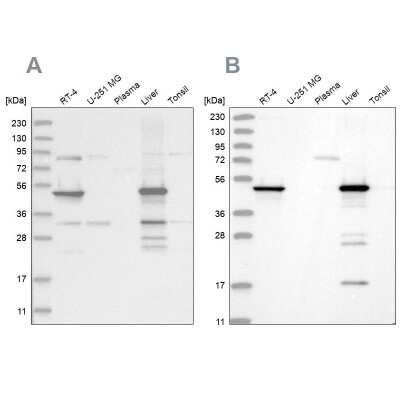 Western Blot: HMGCS2 Antibody [NBP2-33907]