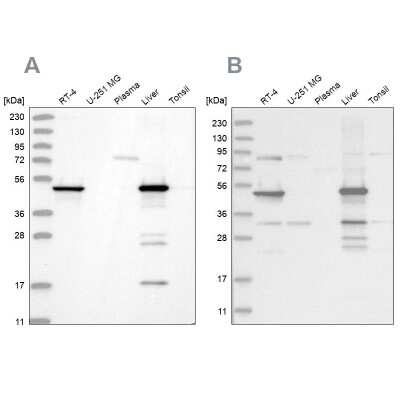 Western Blot: HMGCS2 Antibody [NBP2-33908]