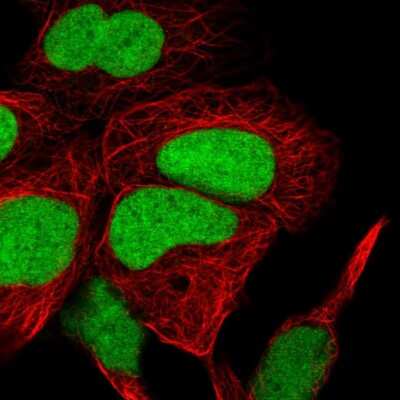 Immunocytochemistry/ Immunofluorescence: HMGN1/HMG14 Antibody [NBP2-47433]