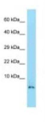 Western Blot: HMGN2 Antibody [NBP1-98427]