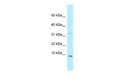 Western Blot: HMGN2 Antibody [NBP2-84069]