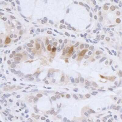 Immunohistochemistry: HMGN3/TRIP7 Antibody [NB100-59840]