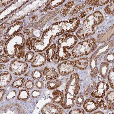Immunohistochemistry-Paraffin: HMX2 Antibody [NBP1-91997]