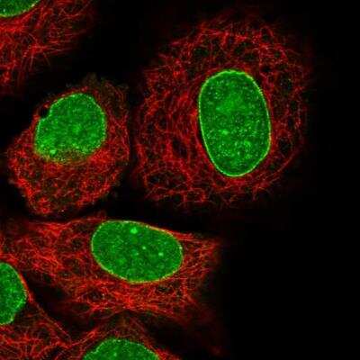 Immunocytochemistry/ Immunofluorescence: HN1 Antibody [NBP2-32492]