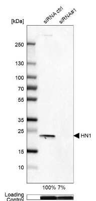 Western Blot: HN1 Antibody [NBP2-32492]