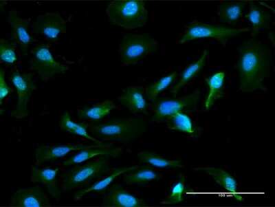 Immunocytochemistry/ Immunofluorescence: HN1L Antibody (1G8) [H00090861-M05]