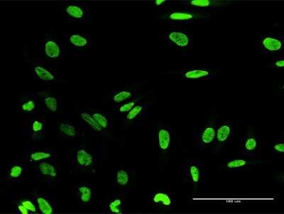 Immunocytochemistry/ Immunofluorescence: HN1L Antibody [H00090861-B01P]
