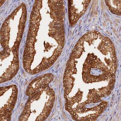 Immunohistochemistry-Paraffin: HN1L Antibody [NBP1-88446]