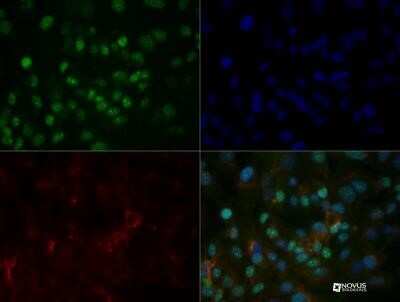 Immunocytochemistry/ Immunofluorescence: HNF-3 alpha/FoxA1 Antibody (3B11NB) - Azide and BSA Free [NBP2-45270]