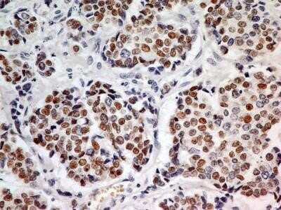 Immunohistochemistry: HNF-3 alpha/FoxA1 Antibody (3B11NB) - Azide and BSA Free [NBP2-45270]