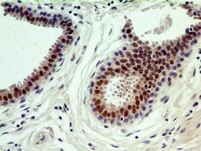 Immunohistochemistry: HNF-3 alpha/FoxA1 Antibody (3B11NB) - Azide and BSA Free [NBP2-45270]