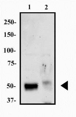 Western Blot: HNF-3 alpha/FoxA1 Antibody (3B11NB)BSA Free [NBP2-45269]