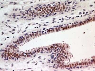 Immunohistochemistry: HNF-3 alpha/FoxA1 Antibody (3B3NB) - Azide and BSA Free [NBP2-45355]
