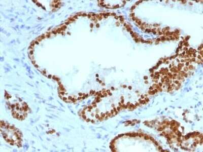Immunohistochemistry-Paraffin: HNF-3 alpha/FoxA1 Antibody (FOXA1/1241) - Azide and BSA Free [NBP2-54357]