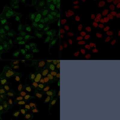 Immunocytochemistry/ Immunofluorescence: HNF-3 alpha/FoxA1 Antibody (FOXA1/1241) [NBP2-53211]