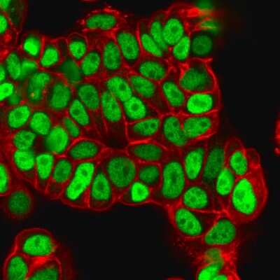 Immunocytochemistry/ Immunofluorescence: HNF-3 alpha/FoxA1 Antibody (FOXA1/1512) - Azide and BSA Free [NBP2-54576]