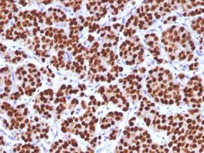 Immunohistochemistry-Paraffin: HNF-3 alpha/FoxA1 Antibody (FOXA1/1512) [NBP2-53337]