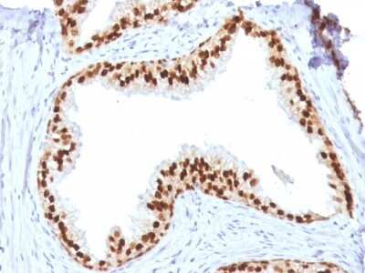 Immunohistochemistry-Paraffin: HNF-3 alpha/FoxA1 Antibody (FOXA1/1512) [NBP2-53337]
