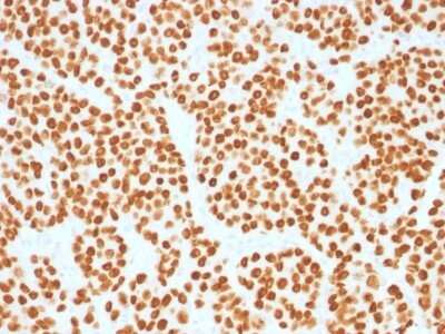 Immunohistochemistry-Paraffin: HNF-3 alpha/FoxA1 Antibody (FOXA1/1515) - Azide and BSA Free [NBP2-54415]