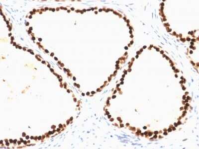 Immunohistochemistry-Paraffin: HNF-3 alpha/FoxA1 Antibody (FOXA1/1515) - Azide and BSA Free [NBP2-54415]