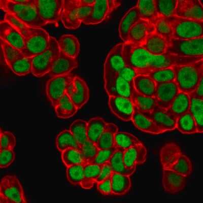 Immunocytochemistry/ Immunofluorescence: HNF-3 alpha/FoxA1 Antibody (FOXA1/1518) [NBP2-53324]