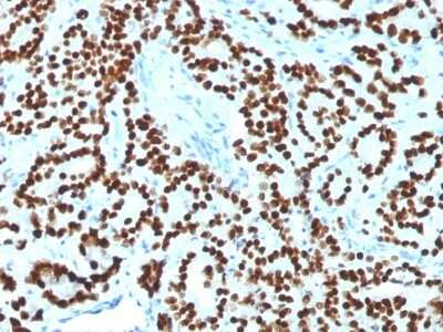 Immunohistochemistry-Paraffin: HNF-3 alpha/FoxA1 Antibody (FOXA1/1518) [NBP2-53324]